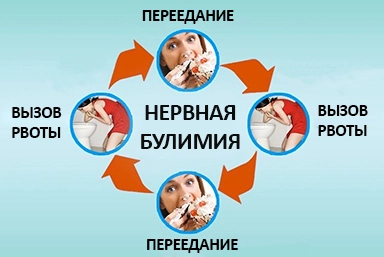 Лечение булимии в Полысаево